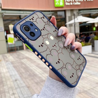 เคสโทรศัพท์มือถือ ซิลิโคน ใส กันกระแทก ลายการ์ตูนกระต่ายน่ารัก สําหรับ Xiaomi 11 11 Lite 4G 11 Lite 5G 11 Lite 5G Ne 11 Pro 11 Ultra