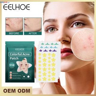 Eelhoe 112patches Star Pimple Patch น่ารักที่มองไม่เห็นสิวแพทช์กำจัด Face Spot Scar Skin Care สติกเกอร์แต่งหน้าคอนซีลเลอร์ Pimple Beauty Tool Linklink