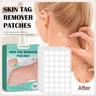 Jaysuing Skin Tag Remover Patches Removal Wart Foot Corn Acne Warts สติกเกอร์สมุนไพรธรรมชาติ Extract Treatment สติกเกอร์ Body Care 12ชิ้น/1กล่อง JOYFEEL