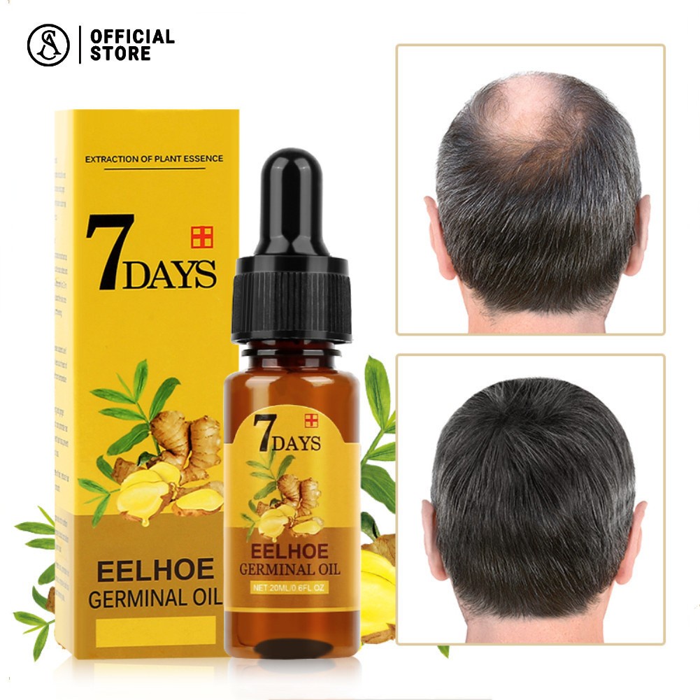 ของแท้100%！เซรั่มปลูกผม ปลูกผม น้ำยาเร่งผมยาว ป้องกันผมร่วง ทำให้รากผมแข็งแรงมากขึ้น เซรั่มปลูกหนวด ยาปลูกผมของแท้ 10ml