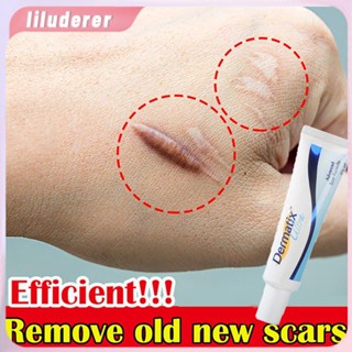 Dermatix Advance Scar เดอร์มาติกซ์ อัลตร้า สการ์ เจล Scar Remover Cream Ubat Parut Luka Scar Cream Scar Treatment Acne Scar HO
