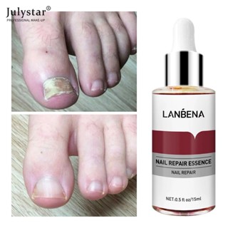 JULYSTAR Lanbena Original Nail Repair Essence เซรั่มบำรุงเล็บเชื้อรา