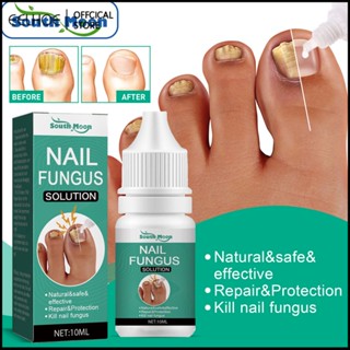 ผลิตภัณฑ์ดูแลเล็บ South Moon Essence Toenail Thickening Onychomycosis คุดเหลือง ซ่อมแซมเล็บให้กระจ่างใส -eelhoe