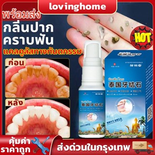 เอาหินปูนออกใน 1 วินาที หินปูน น้ำยากำจัดหินปูน 30ML ขจัดคราบหินปูน น้ำยากำจัดหินปูน ยาสีฟันฟอกฟันขาว Dental stone spray