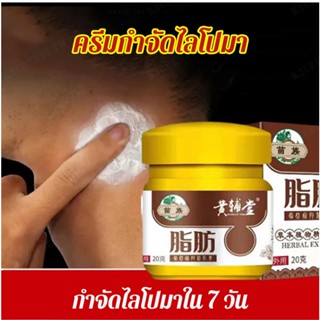 【1/2/3PCS】ยาทากำจัดเนื้องอกไขมัน (กำจัดเนื้องอกไขมันใน 7 วัน)