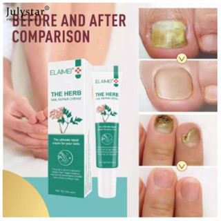 JULYSTAR ครีมซ่อมแซมเล็บ Elaimei ครีมบำรุงเล็บ Onychomycosis Nail Repair Treatment 15g Quick Fix Nail