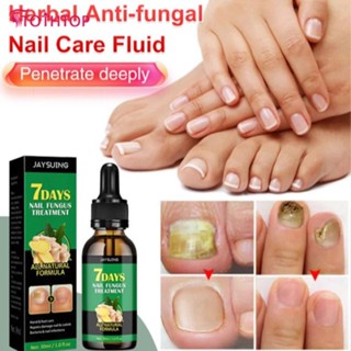 Jaysuing 30ml Nail Fungus Nail Nourishing Serum Nail Healing, Essence, Nail Treatment, Nail Fungal Treatment [ท็อป]