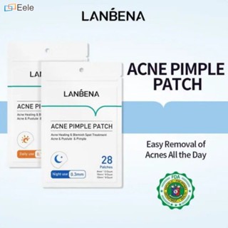 【2PCS SET】LANBENA Pimple Patch Acne Remover Pimple Marks Acne Treatment Day and Night Use Set ↑Eele