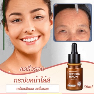 เอสเซนส์บำรุงผิวหน้าปรับปรุงความยืดหยุ่นของผิว ลดริ้วรอย เส้นเล็ก เรตินอล เอสเซนส์บำรุงผิวหน้า 30มล