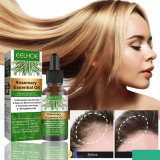 Eelhoe Rosemary Hair Care Essential Oil Anti-frizz Growth Hairs Smooth Serum Hair Oil Anti Hairs Loss New Treatments Hair Beauty Hair[พร้อมส่ง] MOLISA