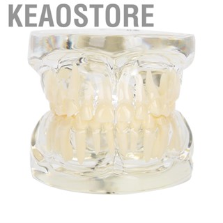 Keaostore Dental Implant Restoration Typodont  Model Removable Study Demo