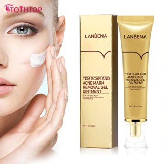 Lanbena Scar Remover Gel Cream Acne Treatment Whitening Removal Serum Stretch Mark Serum Skincare [TOP]