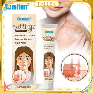 ✧พร้อมส่ง Stcok Sumifun Vitiligo Cream Remove White Spot Ringworm Localized Leukoplakia Disease Treatment Antibacterial Ointment Natural Herbal Extract For Body Care 20g TALLER