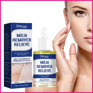 Milia เซรั่มเอสเซ้นบํารุงผิวหน้า กําจัดไขมัน 30 มล.