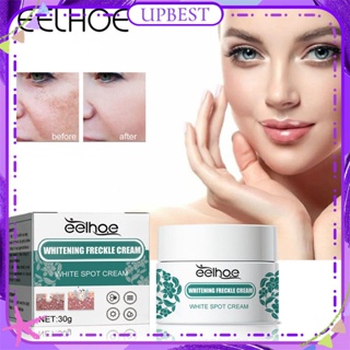 ♕ Eelhoe Whitening Freckle Cream Remove Chloasma Acne Spot Pigment Face Cream Anti-wrinkle Brightening Nourishing Facial Skin Face Care 30g UPBEST