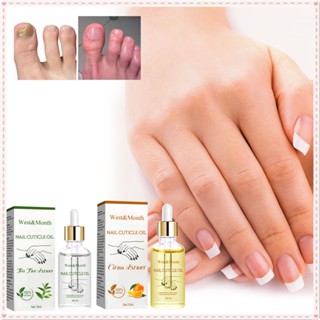 West &amp; month Nail Strengthening Cuticle Oil Repair บำรุงเล็บป้องกันเชื้อราส่งเสริมการเจริญเติบโตของเล็บ Essence Oil Nail Care Product 15ml JOYFEEL