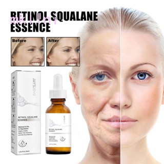 Retinol เซรั่มยกกระชับผิวหน้า ต่อต้านริ้วรอยแห่งวัย ให้ความชุ่มชื้น กระชับผิวหน้า ขนาด 30 มล.