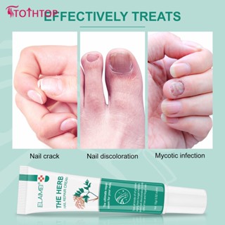 Elaimei Nail Onychomycosis Nutrition Cream ครีมบำรุงเล็บมือและเท้าบำรุงเล็บ [TOP]