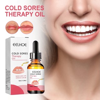 Cold Sores Therapy Oil Cold Sore Treatment Oil Cold Sore Canker Sore Treatment