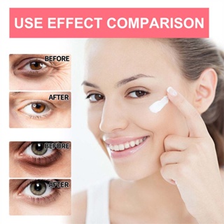 3g EELHOE Retinol Eye Cream Stick - reduce wrinkles and eye edema, tighten the eye area, and fade fine lines