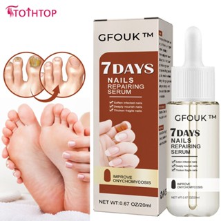 Cfouk 7 Days Nail Repair Essence ฟื้นฟูมือและเท้า Onychomycosis Rotten Toenail Soft [TOP]