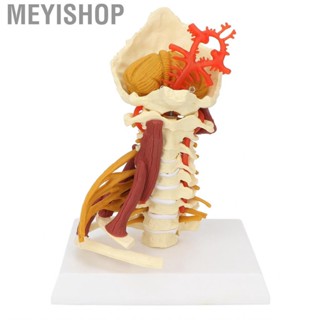 Meyishop Cervical Spine Model Removable Human Spinal Nerves For Doctor Patient ACM