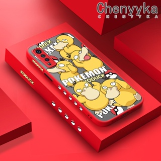 เคสโทรศัพท์มือถือ ซิลิโคนนิ่ม บาง กันกระแทก ลายโปเกม่อน Psyduck แฟชั่น สําหรับ VIVO X50 X50 Pro