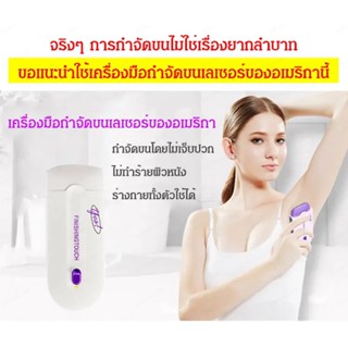 เครื่องกำจัดขนด้วยเลเซอร์