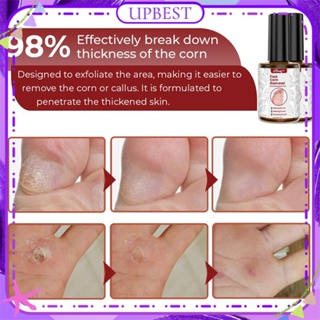 ♕ Cofuk Foot Corn Removal Gel Eliminates Corns Calluses Papillomas Skin Tag Gel Natural Herbal Ingredient Body Care Product 10ml UPBEST