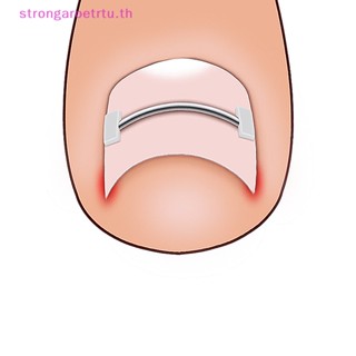 Strongaroetrtu อุปกรณ์ดูแลเล็บเท้า รักษาเล็บคุด แบบมืออาชีพ