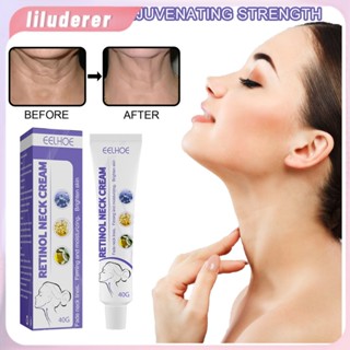 Eelhoe Retinol Cream คอกระชับและริ้วรอยลบครีม Tender Skin Firming Skin Whitening Shaping Moisturizing Beauty คอ Skin Care ผลิตภัณฑ์40G HO