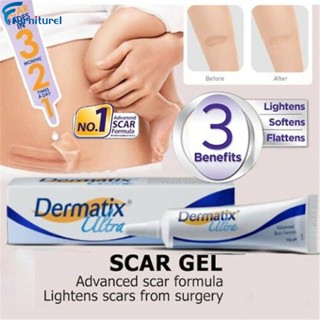 Dermatix 15g ครีมลบรอยแผลเป็น เจลลบรอยแตกลาย ครีมรักษาสิว ฟื้นตัว เผาไหม้ เพื่อผิวเรียบเนียน