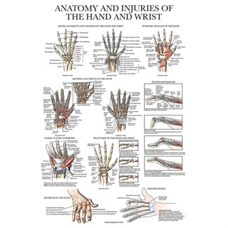โปสเตอร์ลามิเนต กายวิภาคศาสตร์ และการบาดเจ็บที่ข้อมือ และแผนภูมิกายวิภาคข้อมือ