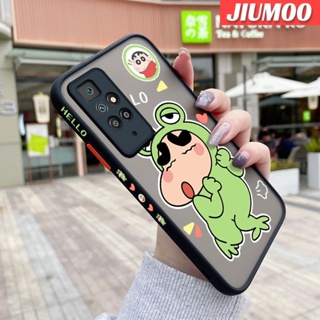 เคสมือถือ แบบใส ลายการ์ตูนชินจัง ขอบสี่เหลี่ยม กันกระแทก สําหรับ Xiaomi Redmi 10 5G Redmi 10 Prime Poco X4 NFC