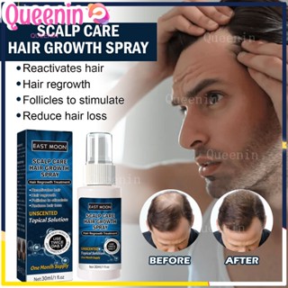 Minoxidil Strands 6% ผลิตภัณฑ์ดูแลเส้นผม สารละลายเฉพาะจุด ปลูกผม เครา ป้องกันผมร่วง กระชับ 60 มล. สําหรับผู้ชายและผู้หญิง