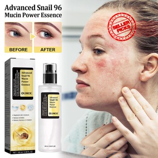 Snail Mucin เอสเซ้นเซรั่มหดรูขุมขน ซ่อมแซมผิวหน้า 96% H9A7