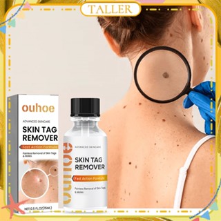 ✧Ready Stcok Ouhoe Skin Tag Remover เซรั่มกำจัดไฝ หูด ผิวเรียบเนียน ไม่ทิ้งรอยแผลเป็น กำจัดสิว Essence Natural Ingredient Body Care 15ml TALLER