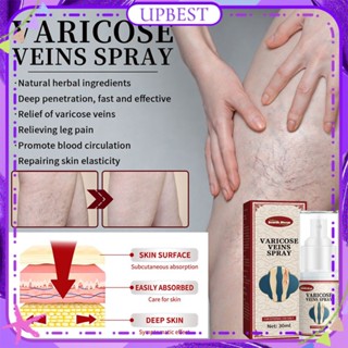 ♕ South Moon Varicose Vein Spray Repair Earthworm Spider Leg บรรเทาอาการปวดบวมไม่สบายตัวแทนซ่อมแซมส่งเสริมการไหลเวียนโลหิต Body Care 30ml UPBEST