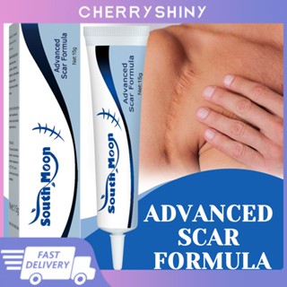 Scar Remover Gel Creamskin Repair Fade Scars Remove Stretch Marks ไวท์เทนนิ่ง