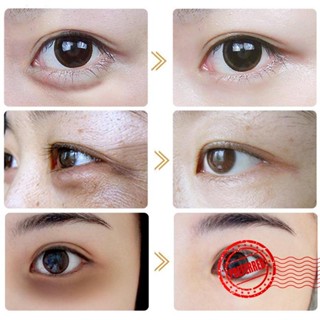 Vova Retinol อายครีมบํารุงรอบดวงตา ลดรอยคล้ําใต้ตา กระชับผิว ขนาด 30 กรัม H4A0