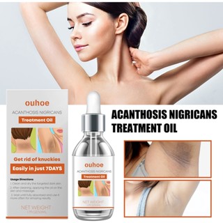 Tiktok same style# OUHOE black ratchet skin essence oil repair underarm joint Black whitening skin fade color spots skin beauty essence oil 8.8g