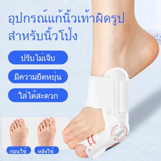 Hallux valgus เฝือกแก้ไข