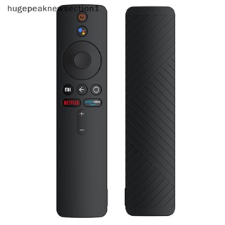 Hugepeaknewsection1 เคสป้องกัน คุณภาพสูง แบบเปลี่ยน สําหรับ Xiaomi TV Box S Gen Mi TV Stick