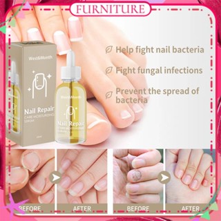 West &amp; month Nail Repair Care Moisturizing Serum Anti Itching Burning Scaling Cracking Nursing Solution Natural Ingredient Body Care 20ml FURNITURE