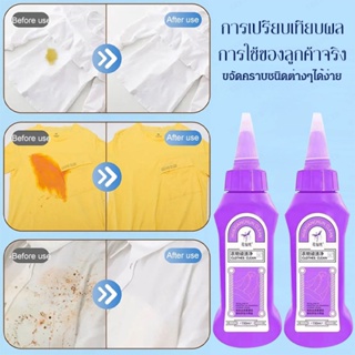 อุปกรณ์กําจัดคราบเสื้อผ้า ทําความสะอาดเสื้อผ้า