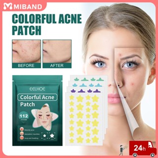 Eelhoe 2023 Tiktok Ins Acne Patches 112 Pcs Waterproof Oil-control Acne Patch Blemish Treatment Skin Care Acne Repair Women นักเรียนหญิง