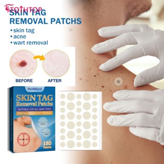 West &amp; month 180pcs Skin Tags Patch Patch ไม่เจ็บปวด Wart Treatment Remove Flat Warts Corns Acne Anti-infection Invisible Hydrocolloid Gel Body Care [TOP]