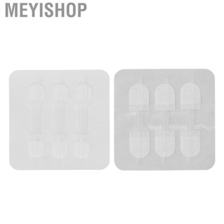 Meyishop Emergency Wound Closure Device  Zipper Reduce Scars Length Adjust for Outdoor Use