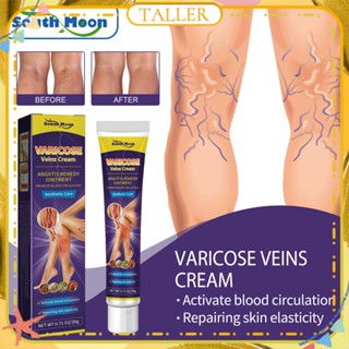 ✧Ready Stcok South Moon Varicose Vein Cream Repairs Blood Vessels Earthworm Improve Spider Veins Relieves Leg Swelling Pain Treatment Body Care TALLER สูง