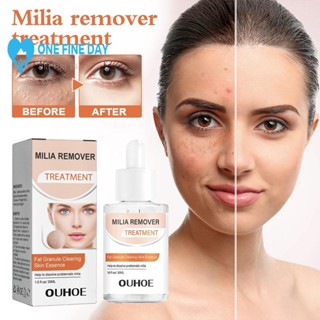 Milia Remover Essence เซรั่มบํารุงรอบดวงตา 30 มล. G7R2